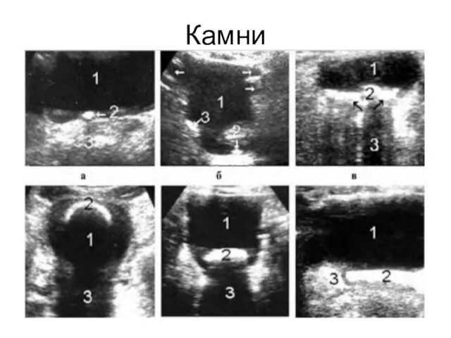 Камни