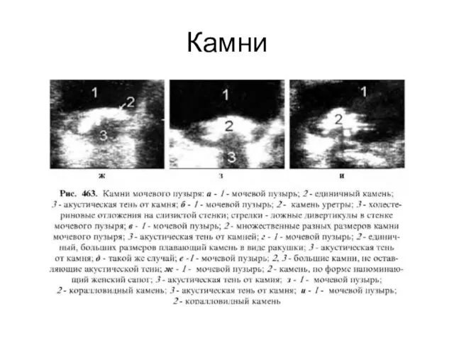 Камни