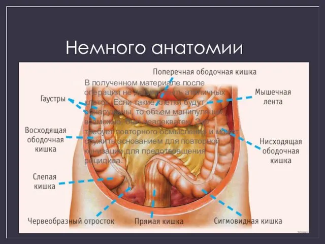 Немного анатомии В полученном материале после операции не должно быть