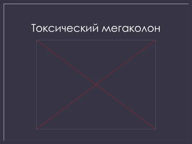 Токсический мегаколон