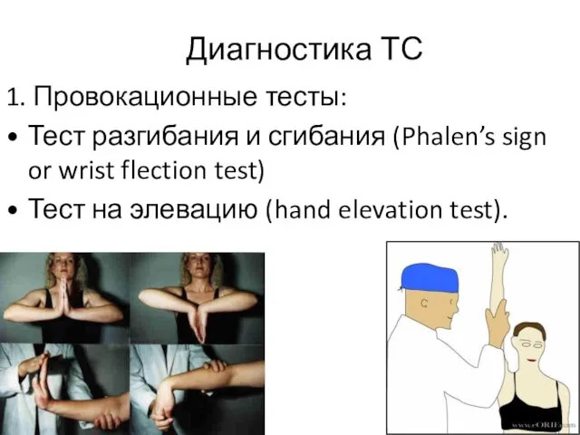 Диагностика ТС 1. Провокационные тесты: Тест разгибания и сгибания (Phalen’s sign or wrist
