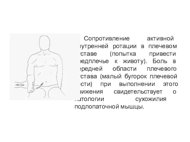 Сопротивление активной внутренней ротации в плечевом суставе (попытка привести предплечье к животу). Боль