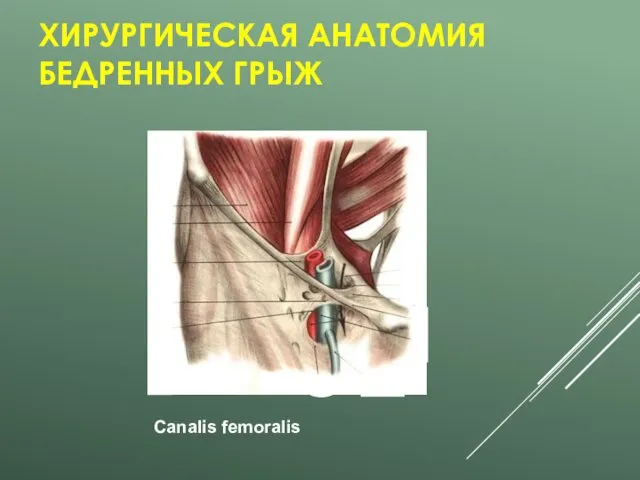 ХИРУРГИЧЕСКАЯ АНАТОМИЯ БЕДРЕННЫХ ГРЫЖ Canalis femoralis