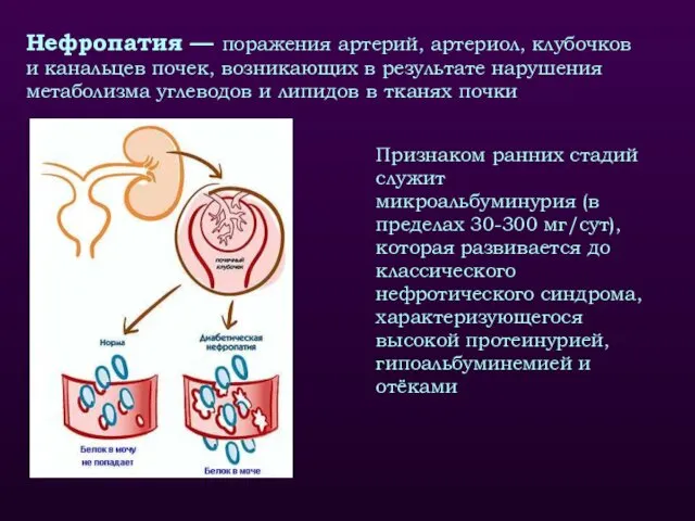 Нефропатия — поражения артерий, артериол, клубочков и канальцев почек, возникающих