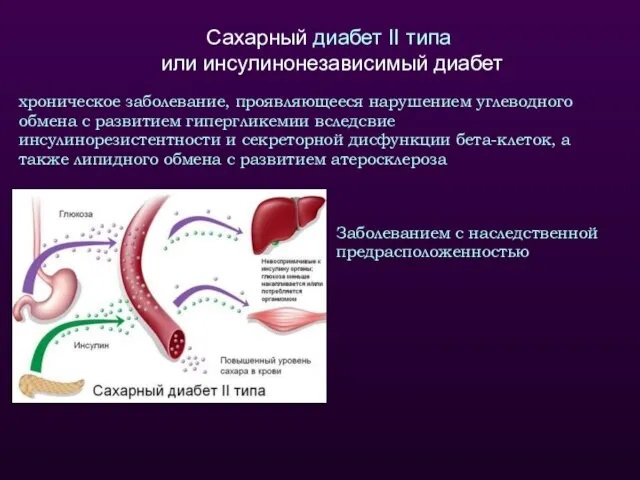 Сахарный диабет II типа или инсулинонезависимый диабет хроническое заболевание, проявляющееся