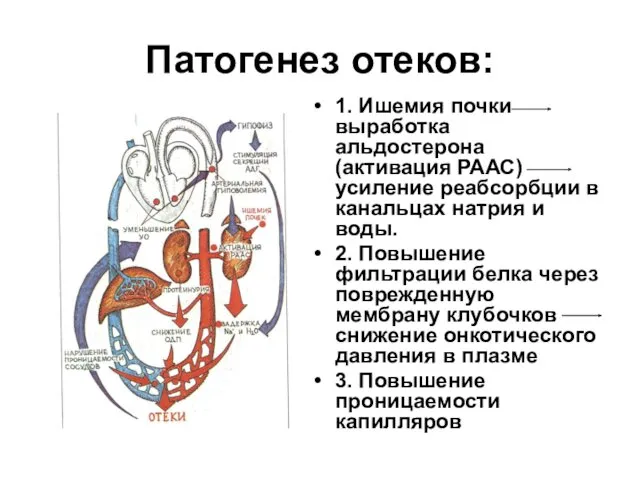 Патогенез отеков: 1. Ишемия почки выработка альдостерона (активация РААС) усиление