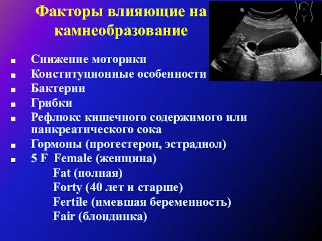 Факторы влияющие на камнеобразование Снижение моторики Конституционные особенности Бактерии Грибки