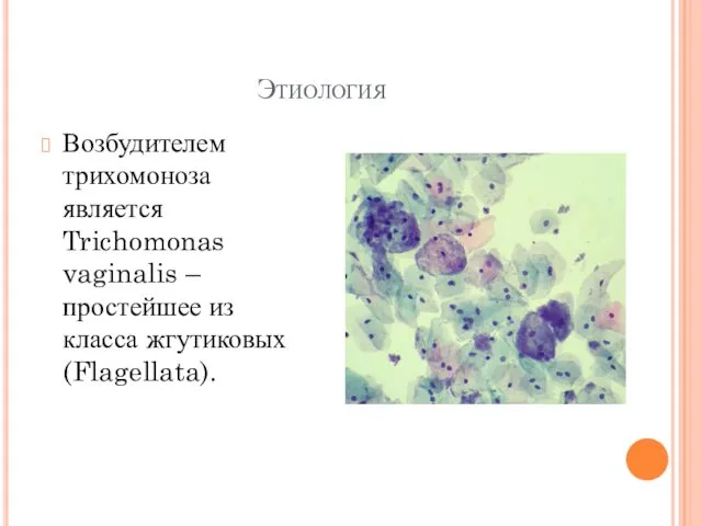 Этиология Возбудителем трихомоноза является Trichomonas vaginalis – простейшее из класса жгутиковых (Flagellata).