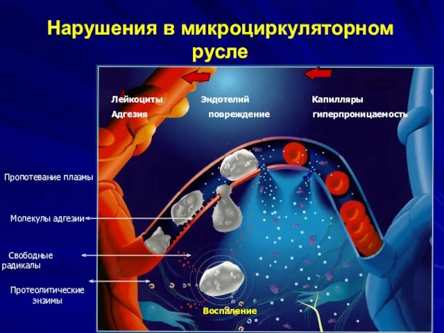 Нарушения в микроциркуляторном русле Лейкоциты Эндотелий Капилляры Адгезия повреждение гиперпроницаемость