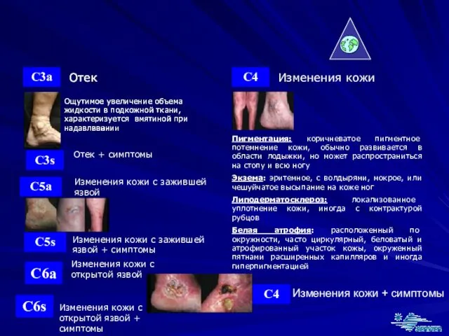 C4 Изменения кожи Пигментация: коричневатое пигментное потемнение кожи, обычно развивается