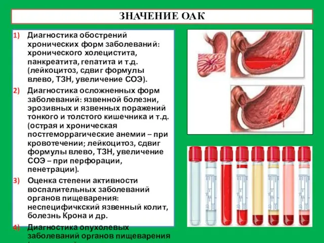 ЗНАЧЕНИЕ ОАК Диагностика обострений хронических форм заболеваний: хронического холецистита, панкреатита,