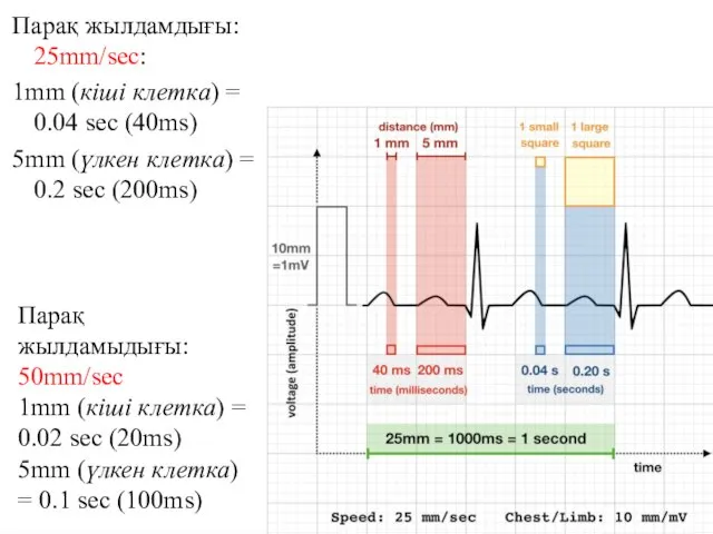 Парақ жылдамдығы: 25mm/sec: 1mm (кіші клетка) = 0.04 sec (40ms)