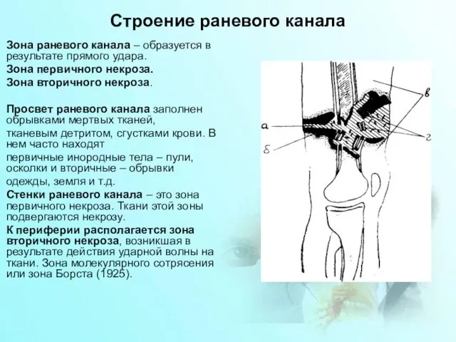 Строение раневого канала Зона раневого канала – образуется в результате