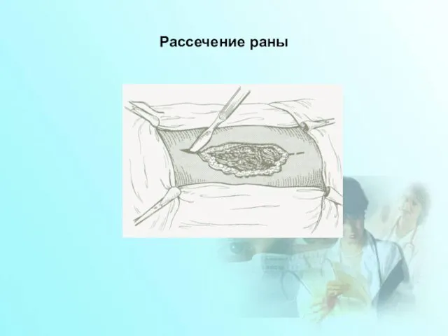 Рассечение раны