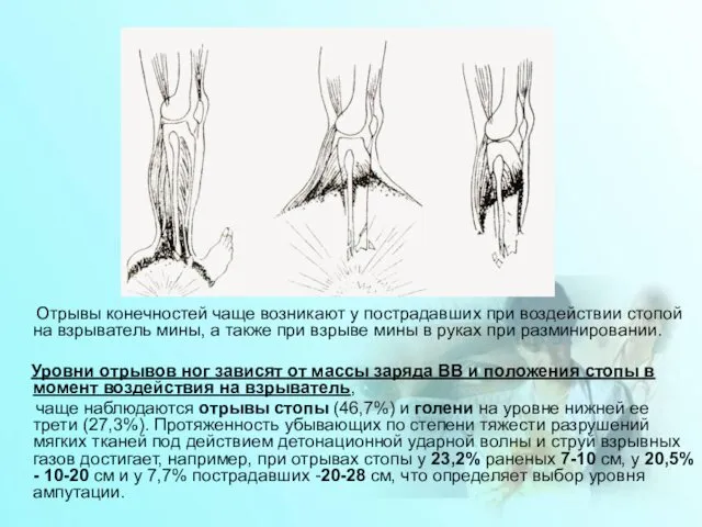 Отрывы конечностей чаще возникают у пострадавших при воздействии стопой на