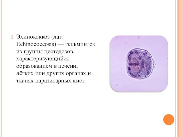 Эхинококкоз (лат. Echinococcosis) — гельминтоз из группы цестодозов, характеризующийся образованием