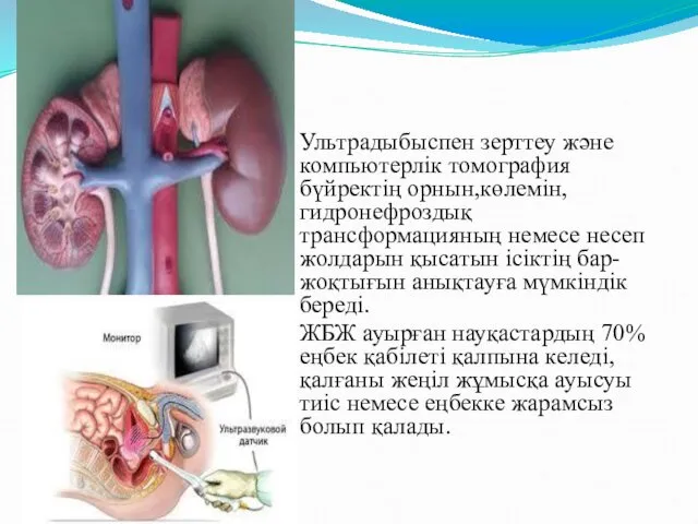 Ультрадыбыспен зерттеу және компьютерлік томография бүйректің орнын,көлемін,гидронефроздық трансформацияның немесе несеп жолдарын қысатын ісіктің