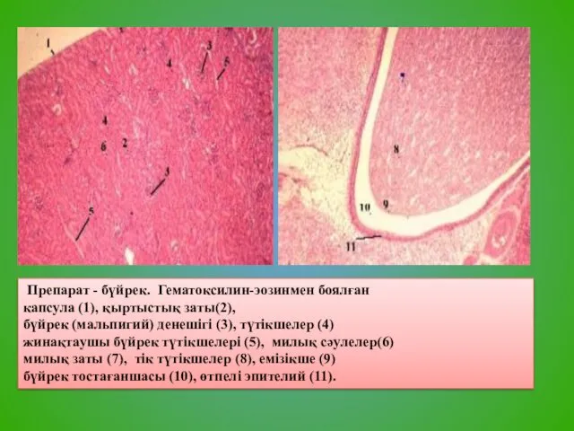Препарат - бүйрек. Гематоксилин-эозинмен боялған капсула (1), қыртыстық заты(2), бүйрек (мальпигий) денешігі (3),