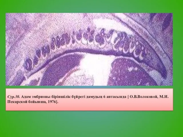 Сур.30. Адам эмбрионы біріншілік бүйрегі дамудың 6 аптасында [ О.В.Волоковой, М.И.Пекарской бойынша, 1976].