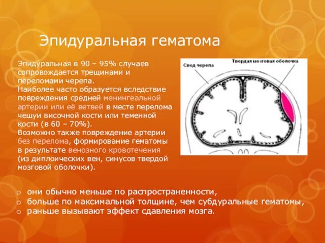 Эпидуральная гематома Эпидуральная в 90 – 95% случаев сопровождается трещинами