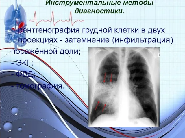 Инструментальные методы диагностики. рентгенография грудной клетки в двух проекциях -
