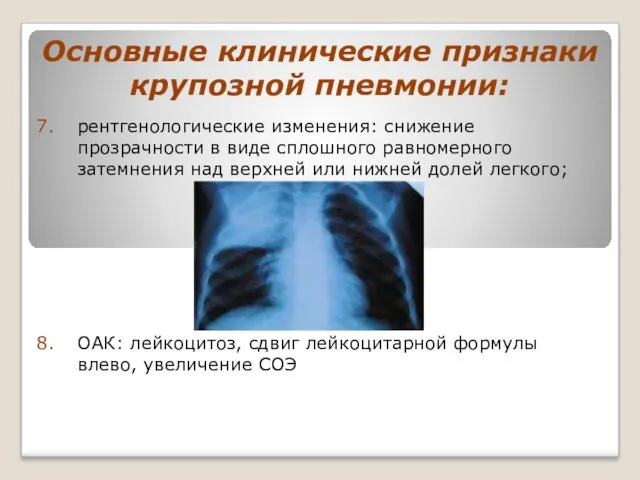 Основные клинические признаки крупозной пневмонии: рентгенологические изменения: снижение прозрачности в