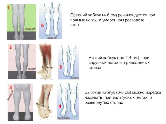 Средний каблук (4-6 см) рекомендуется при прямых ногах и умеренном