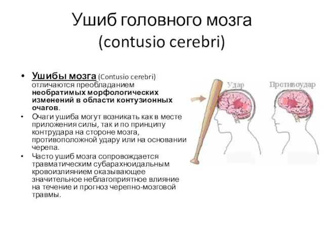 Ушиб головного мозга (contusio cerebri) Ушибы мозга (Contusio cerebri) отличаются