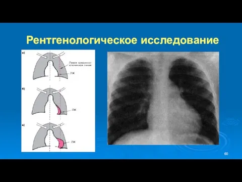 Рентгенологическое исследование