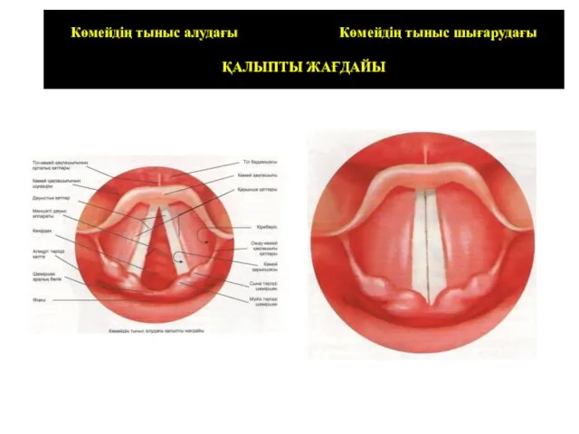 Көмейдің тыныс алудағы Көмейдің тыныс шығарудағы ҚАЛЫПТЫ ЖАҒДАЙЫ