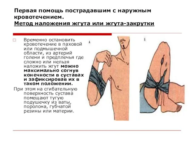 Первая помощь пострадавшим с наружным кровотечением. Метод наложения жгута или