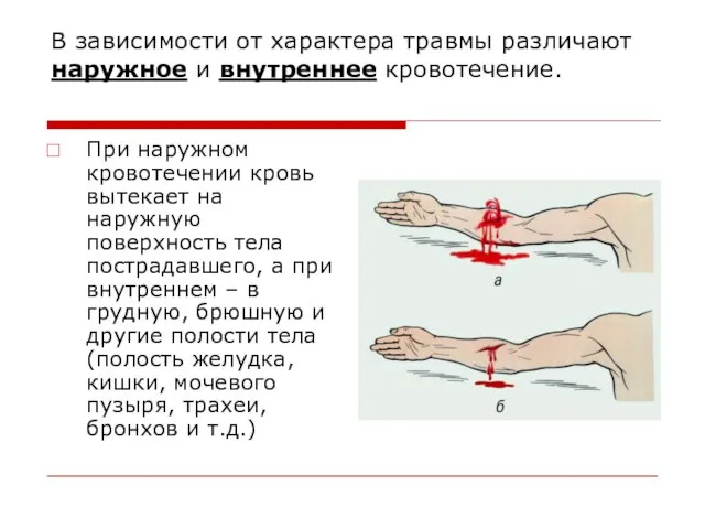 В зависимости от характера травмы различают наружное и внутреннее кровотечение.