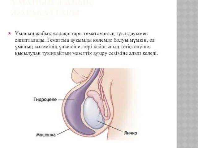 ҰМАНЫҢ ЖАБЫҚ ЖАРАҚАТТАРЫ Ұманың жабық жарақаттары гематоманың туындауымен сипатталады. Гематома