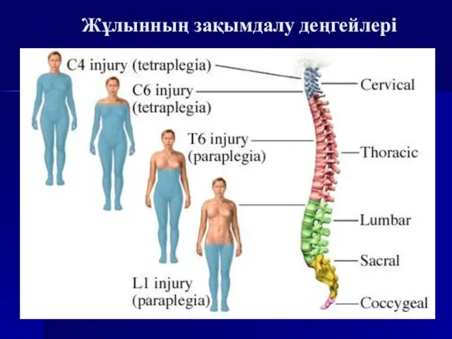 Жұлынның зақымдалу деңгейлері