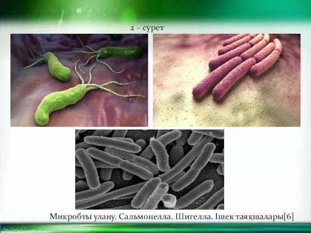 2 – сурет Микробты улану. Сальмонелла. Шигелла. Ішек таяқшалары[6]