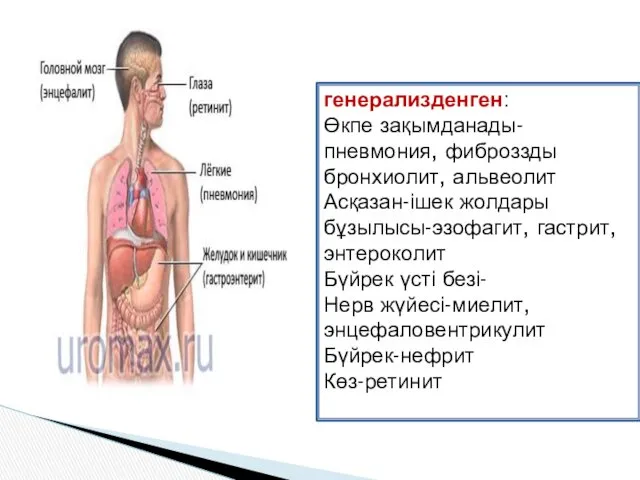 генерализденген: Өкпе зақымданады-пневмония, фиброззды бронхиолит, альвеолит Асқазан-ішек жолдары бұзылысы-эзофагит, гастрит,