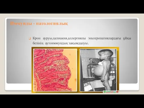 Иммунды - патологиялық Крон ауруы,целиакия,аллергиялы эньтеропатиялардағы ұйқы безінің аутоиммундық зақымдалуы.