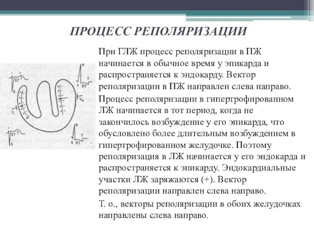 ПРОЦЕСС РЕПОЛЯРИЗАЦИИ При ГЛЖ процесс реполяризации в ПЖ начинается в