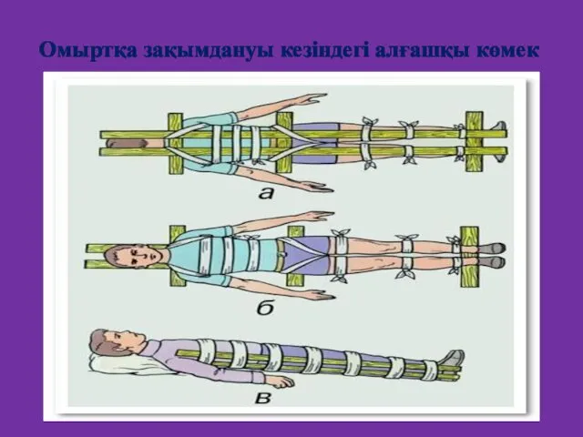 Омыртқа зақымдануы кезіндегі алғашқы көмек