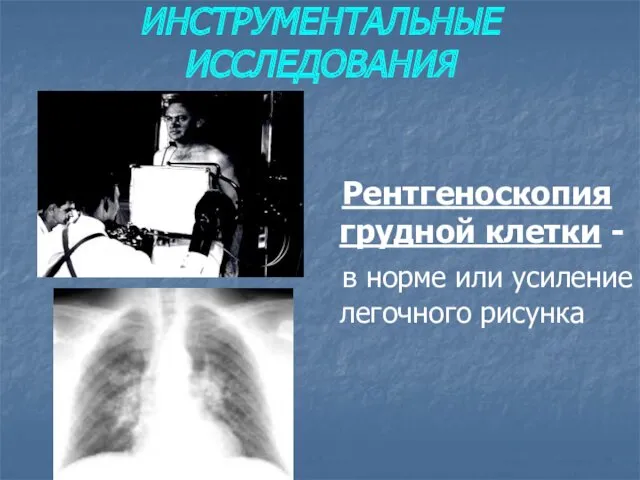 ИНСТРУМЕНТАЛЬНЫЕ ИССЛЕДОВАНИЯ Рентгеноскопия грудной клетки - в норме или усиление легочного рисунка