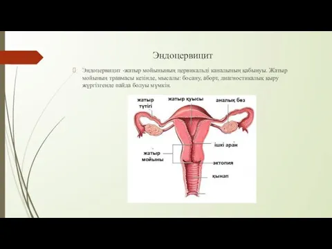 Эндоцервицит Эндоцервицит -жатыр мойынының цервикальді каналының қабынуы. Жатыр мойының травмасы