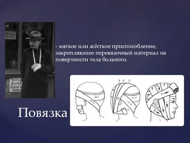 - мягкое или жёсткое приспособление, закрепляющее перевязочный материал на поверхности тела больного. Повязка