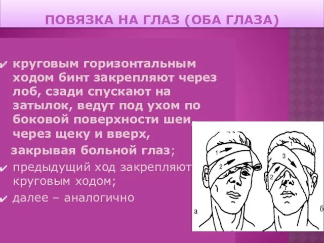 ПОВЯЗКА НА ГЛАЗ (ОБА ГЛАЗА) круговым горизонтальным ходом бинт закрепляют