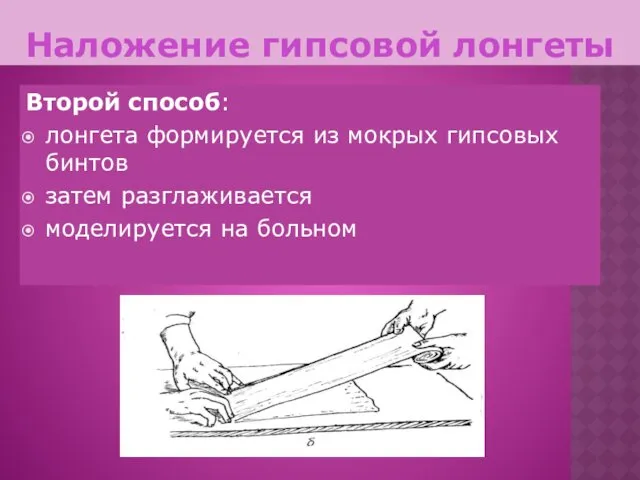 Наложение гипсовой лонгеты Второй способ: лонгета формируется из мокрых гипсовых бинтов затем разглаживается моделируется на больном