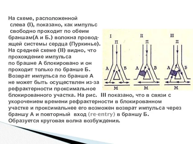 На схеме, расположенной слева (I), показано, как импульс свободно проходит