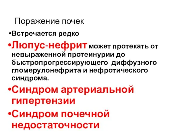 Поражение почек Встречается редко Люпус-нефрит может протекать от невыраженной протеинурии