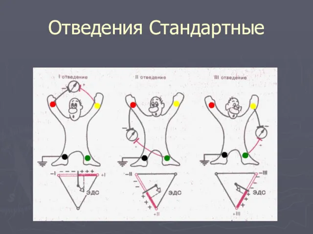 Отведения Стандартные