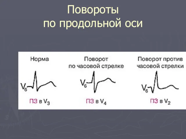 Повороты по продольной оси