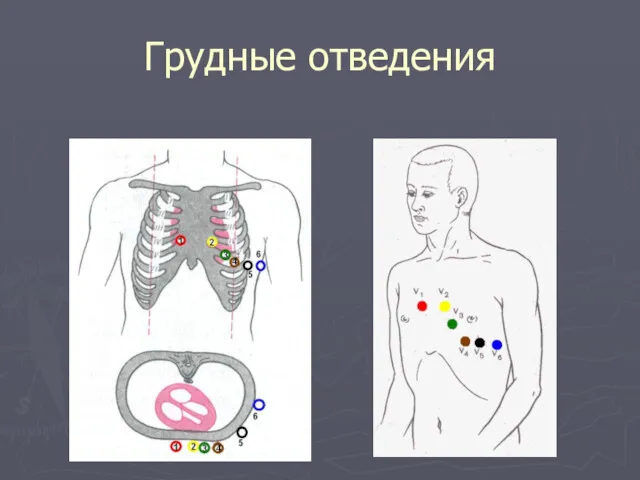 Грудные отведения