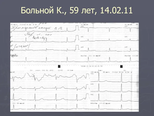 Больной К., 59 лет, 14.02.11